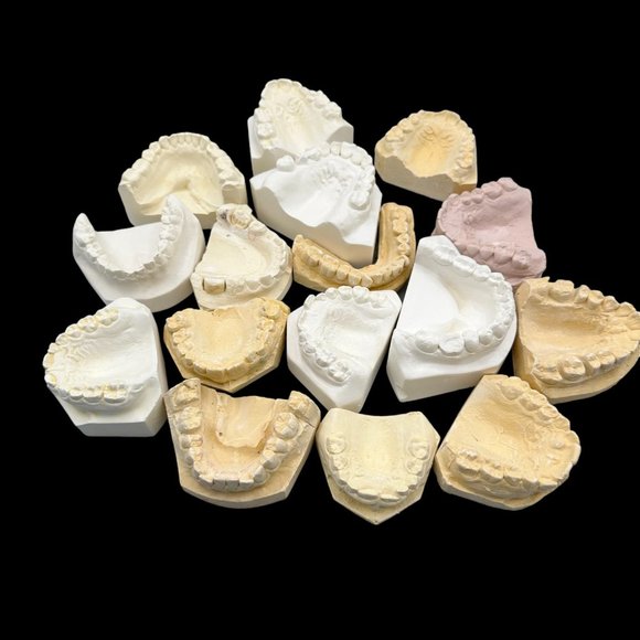 Vintage Plaster Dental Mold - Teeth Tooth Mold - Creepy Oddity - Dental Oddities - Picture 5 of 16